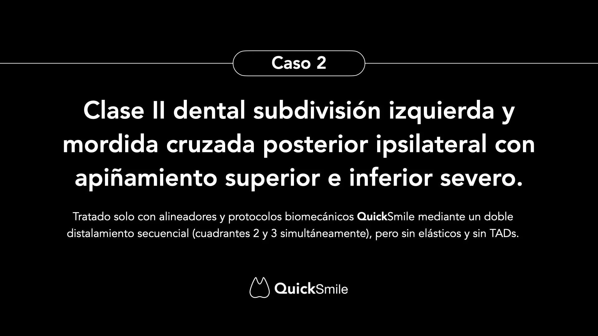 Clase II dental subdivisión izquierda y mordida cruzada posterior ipsilateral: doble distalamiento secuencial solo con alineadores