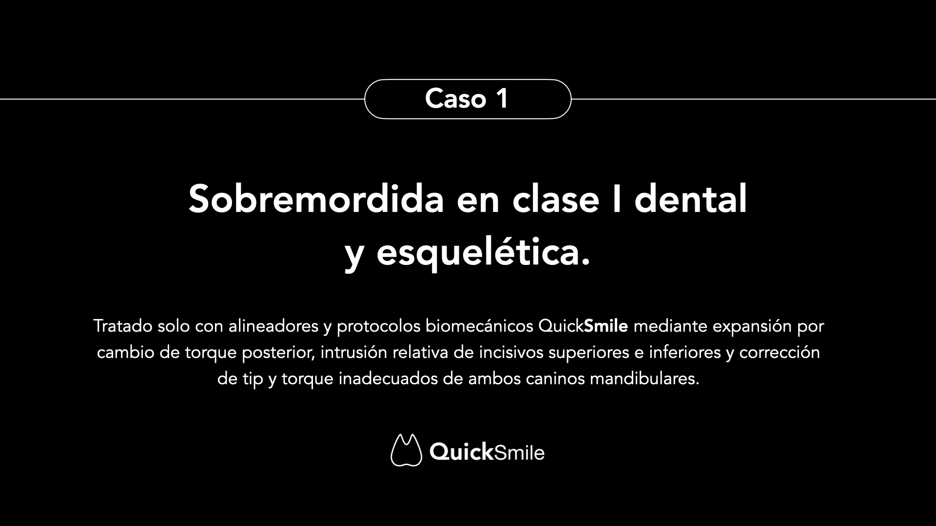 Sobremordida en clase I dental y esquelética: expansión por torque e intrusión relativa solo con alineadores