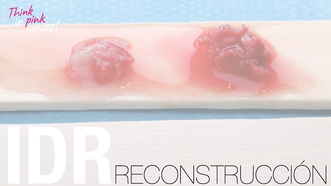 Xurxo Álvarez Lourido