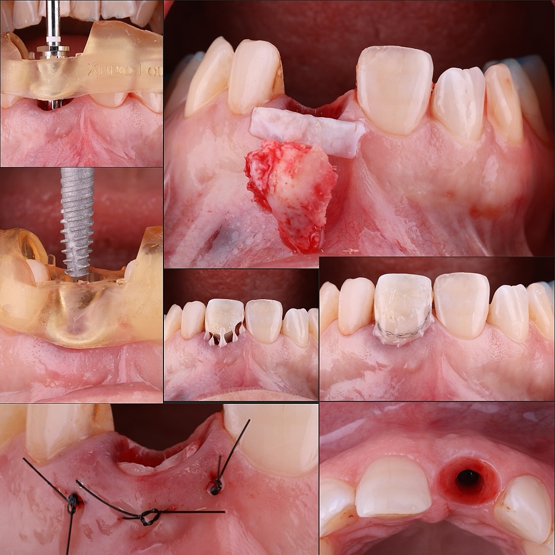 Xurxo Álvarez Lourido